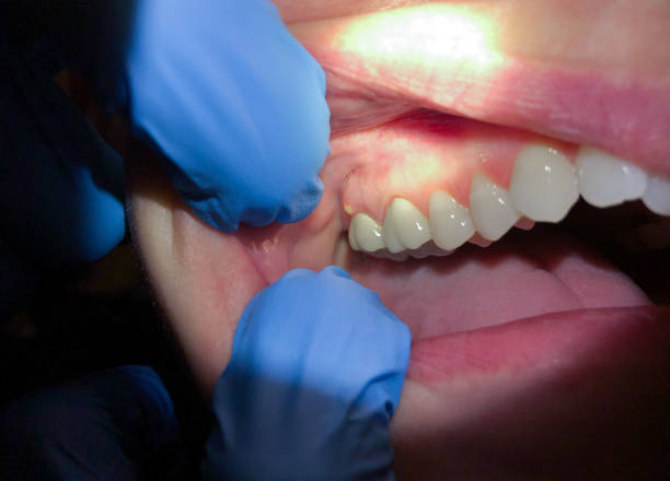 Best Emergency Orthodontic Repairs in Hudsonville, MI